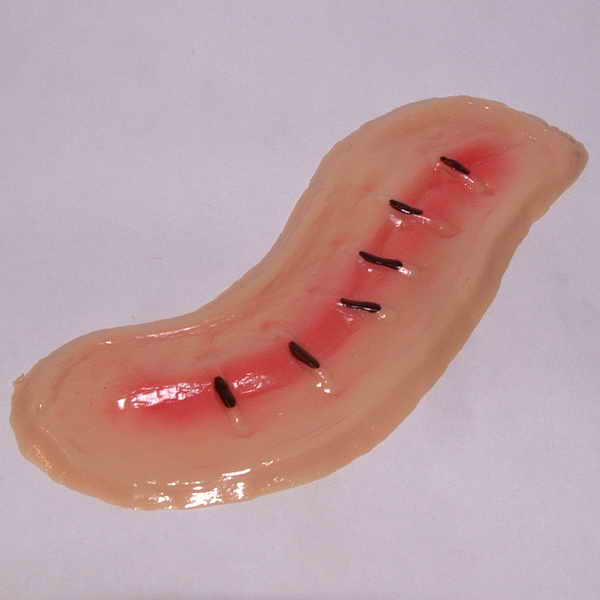 Wound (image)